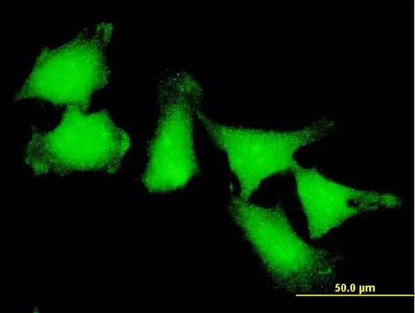 ATOX1 Antibody in Immunocytochemistry (ICC/IF)