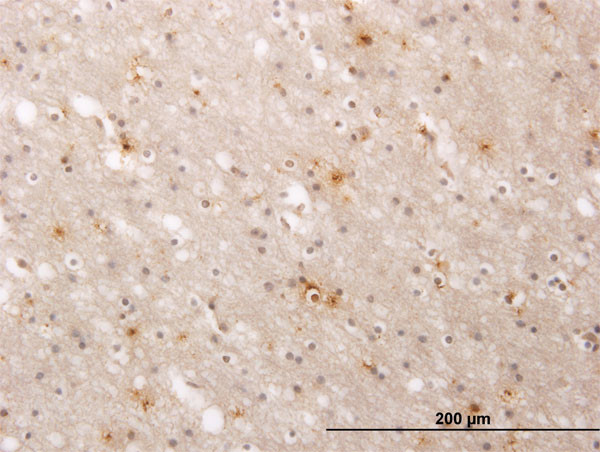 ATP2A1 Antibody in Immunohistochemistry (Paraffin) (IHC (P))