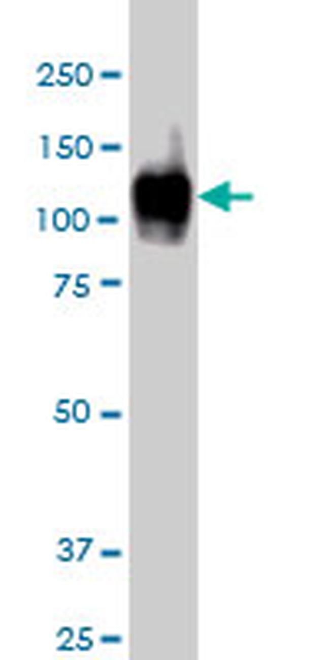 ATP2A1 Antibody in Western Blot (WB)