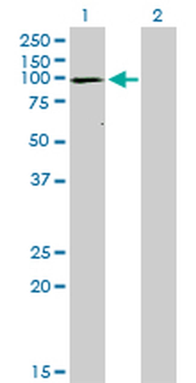 ATP2A1 Antibody in Western Blot (WB)