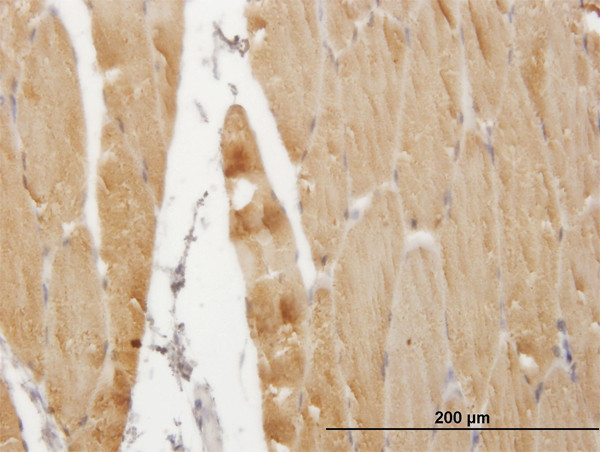 ATP2A1 Antibody in Immunohistochemistry (Paraffin) (IHC (P))