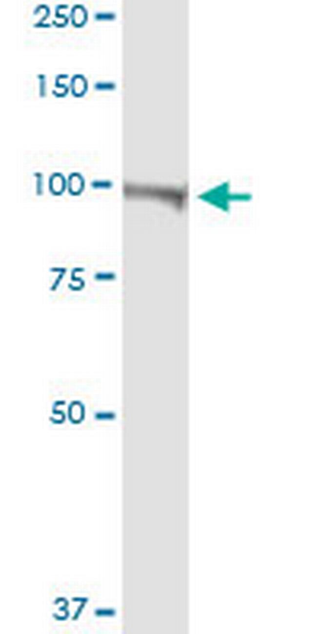 ATP2B4 Antibody in Western Blot (WB)