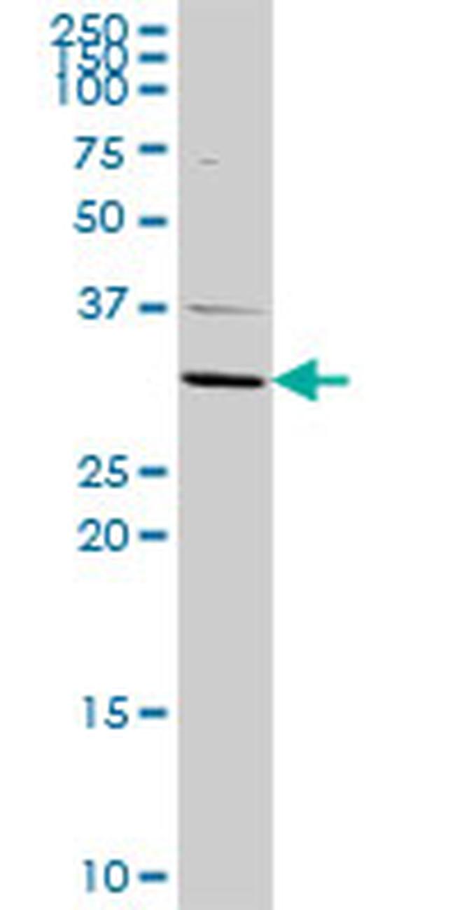 ATP4B Antibody in Western Blot (WB)