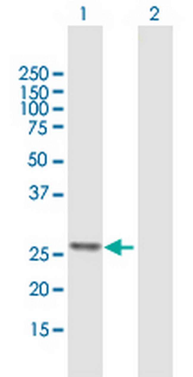 ATP5F1 Antibody in Western Blot (WB)