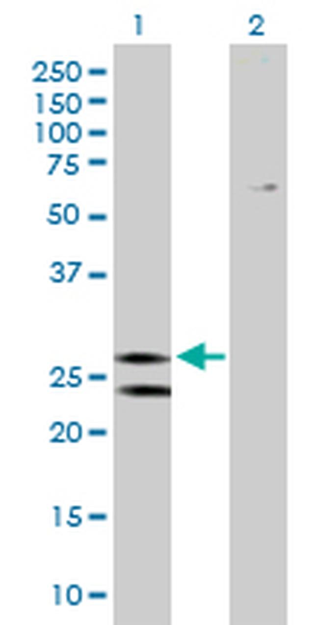 ATP5F1 Antibody in Western Blot (WB)