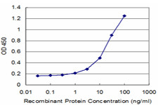 ATP5J Antibody in ELISA (ELISA)