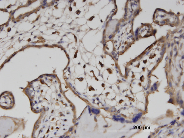 ATP6V1A Antibody in Immunohistochemistry (Paraffin) (IHC (P))