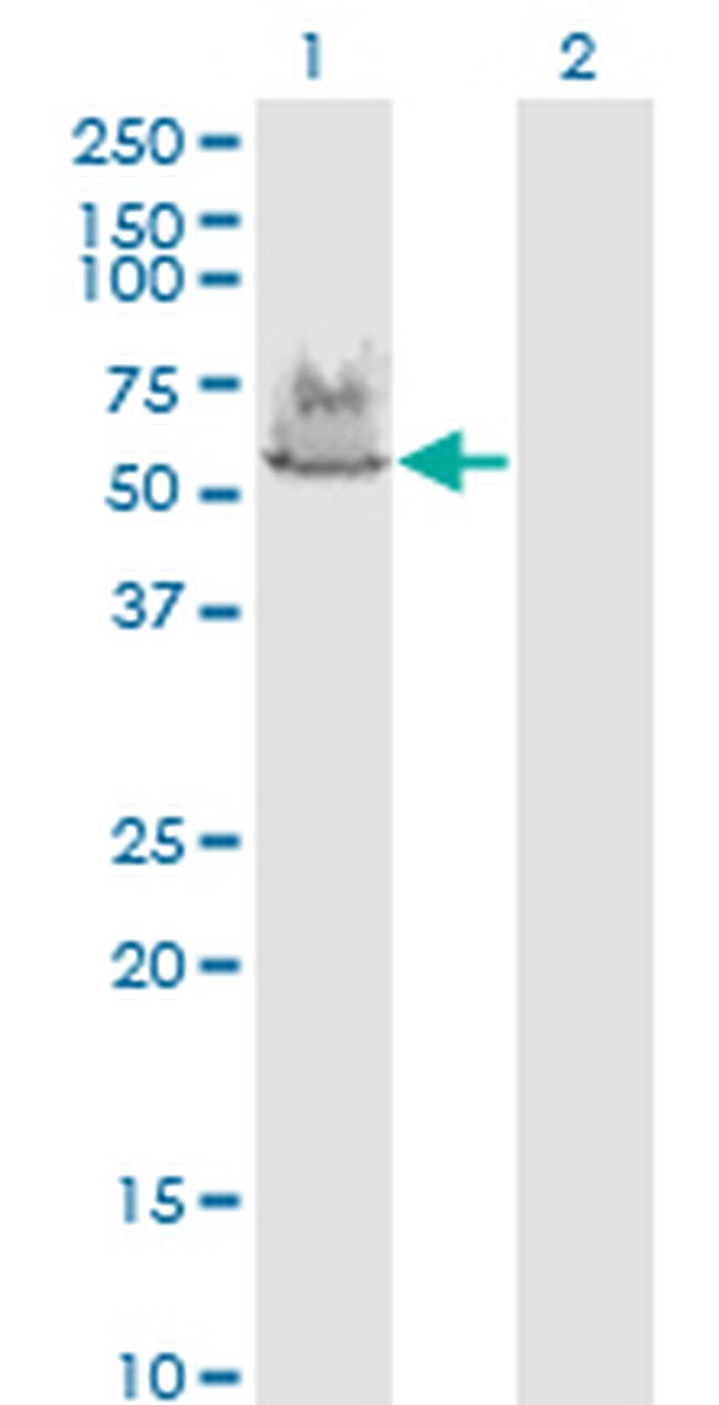 ATP6V1A Antibody in Western Blot (WB)