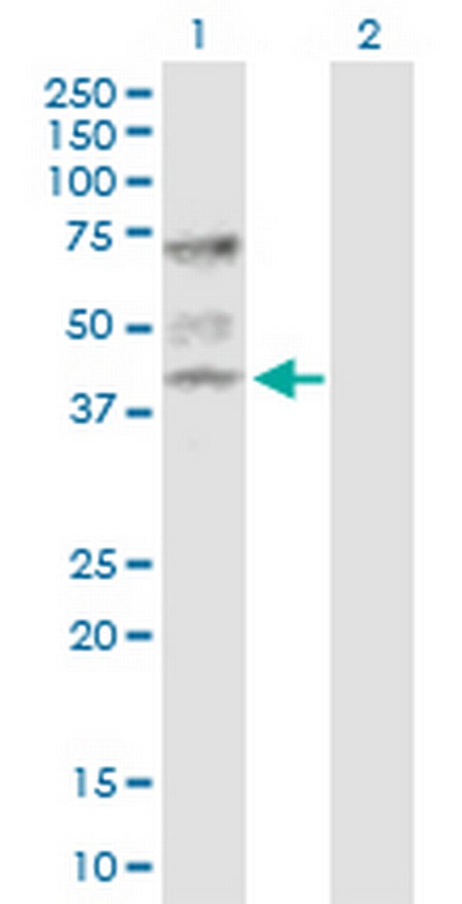 ATP6V1C1 Antibody in Western Blot (WB)