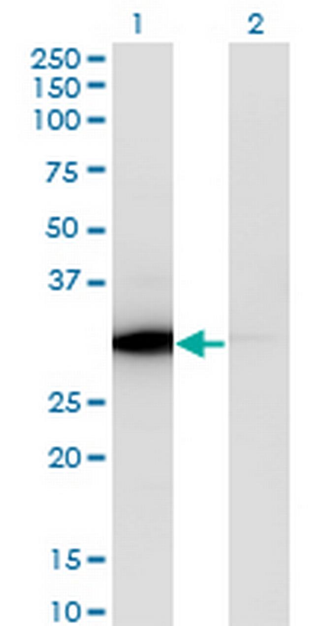 ATP6V1E1 Antibody in Western Blot (WB)