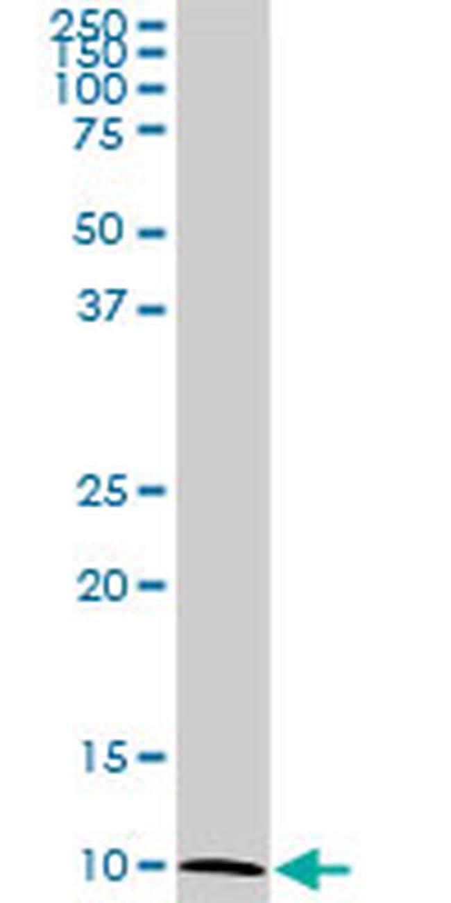 ATP6V1G2 Antibody in Western Blot (WB)