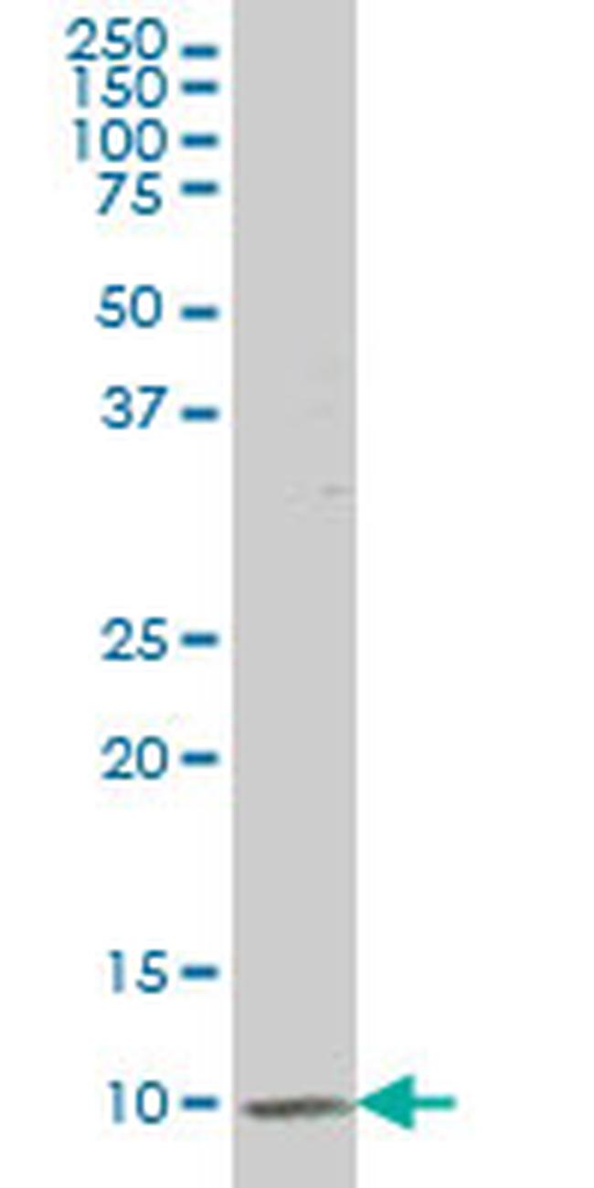 ATP6V1G2 Antibody in Western Blot (WB)