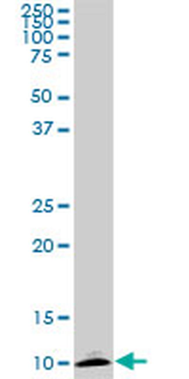 ATP6V1G2 Antibody in Western Blot (WB)