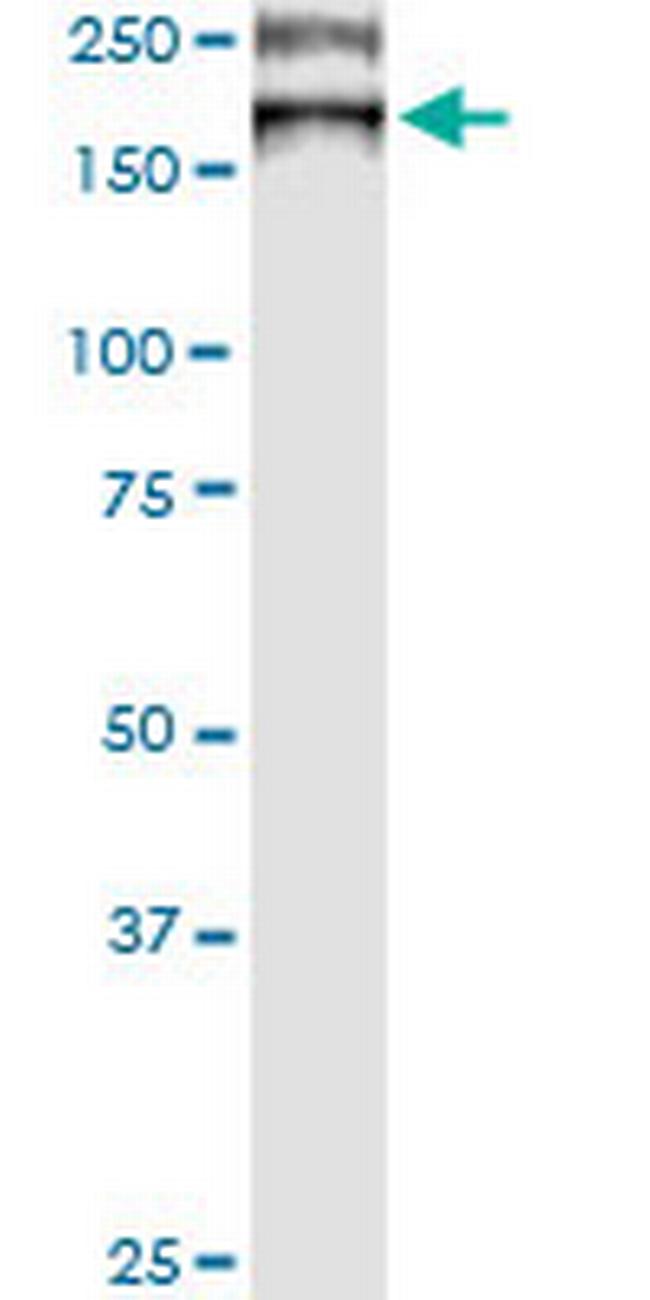 ATP7B Antibody in Western Blot (WB)