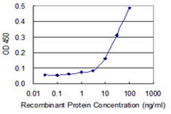 AUH Antibody in ELISA (ELISA)