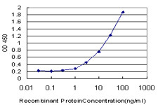 AXL Antibody in ELISA (ELISA)