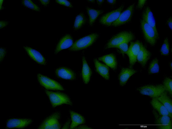 B2M Antibody in Immunocytochemistry (ICC/IF)