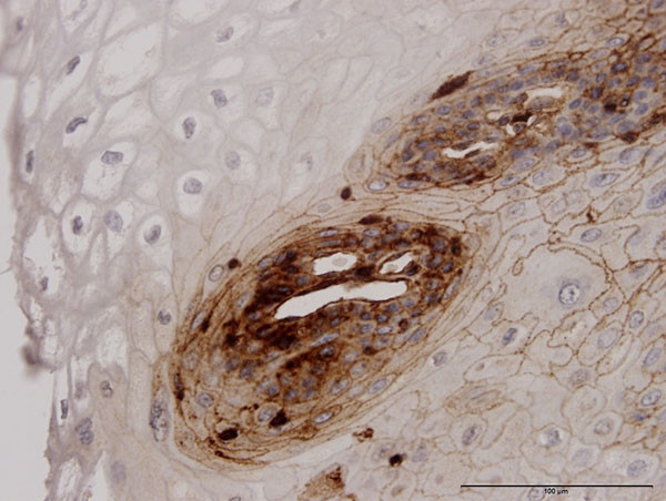 B2M Antibody in Immunohistochemistry (Paraffin) (IHC (P))