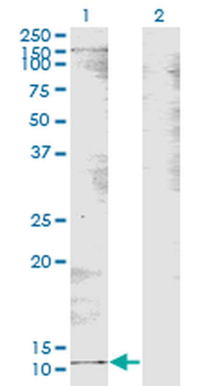 B2M Antibody in Western Blot (WB)