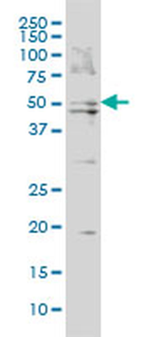 BAAT Antibody in Western Blot (WB)