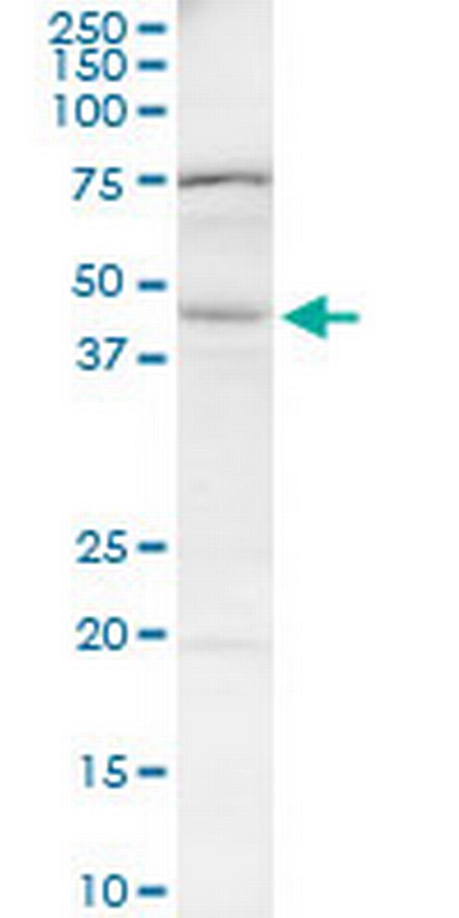 BAAT Antibody in Western Blot (WB)