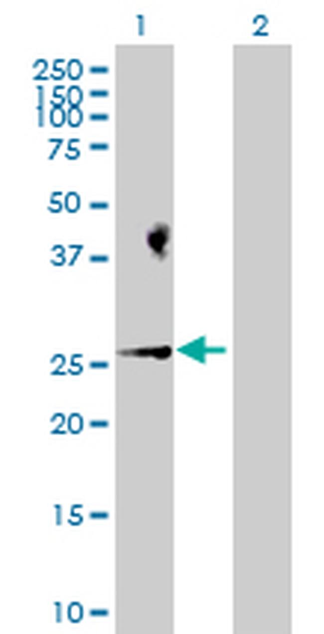 BAD Antibody in Western Blot (WB)