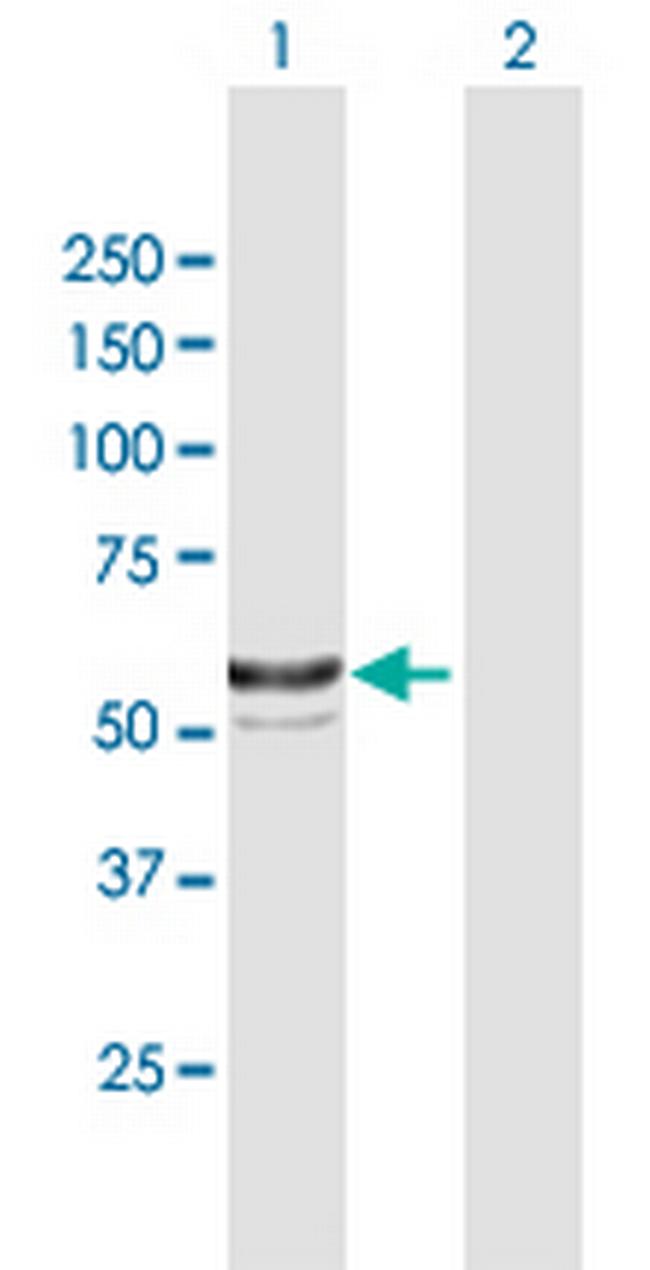 BBS4 Antibody in Western Blot (WB)