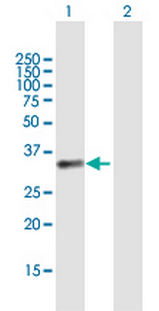 BCAT1 Antibody in Western Blot (WB)