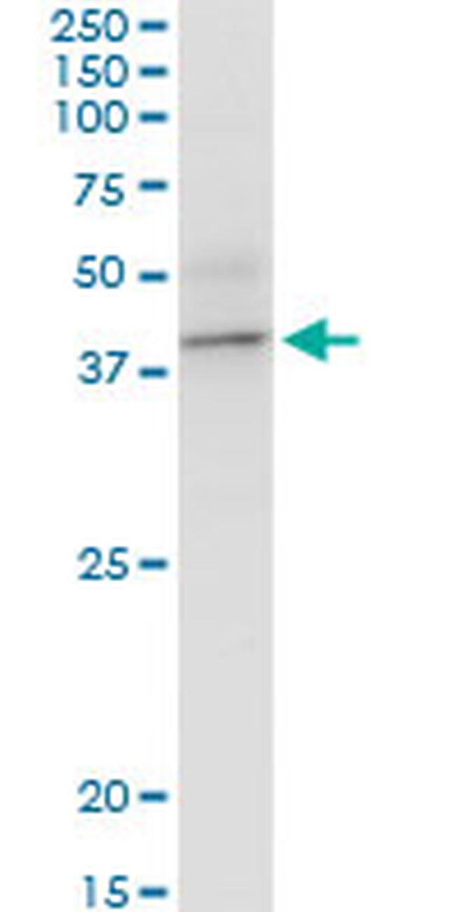 BCAT2 Antibody in Western Blot (WB)