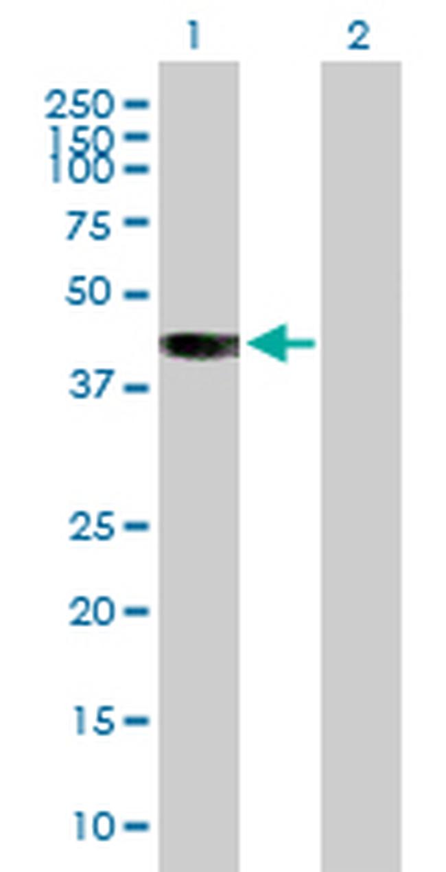 BCAT2 Antibody in Western Blot (WB)