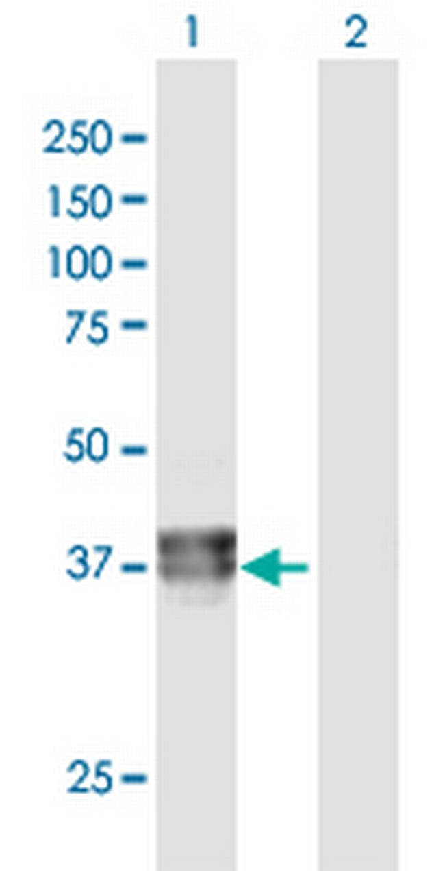 BCAT2 Antibody in Western Blot (WB)