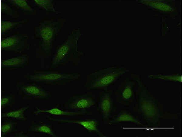 BCL2L1 Antibody in Immunocytochemistry (ICC/IF)