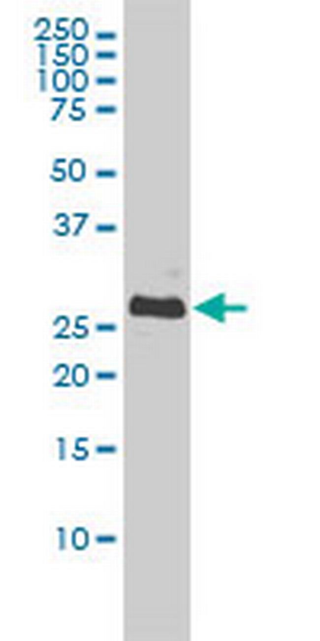 BCL2L1 Antibody in Western Blot (WB)