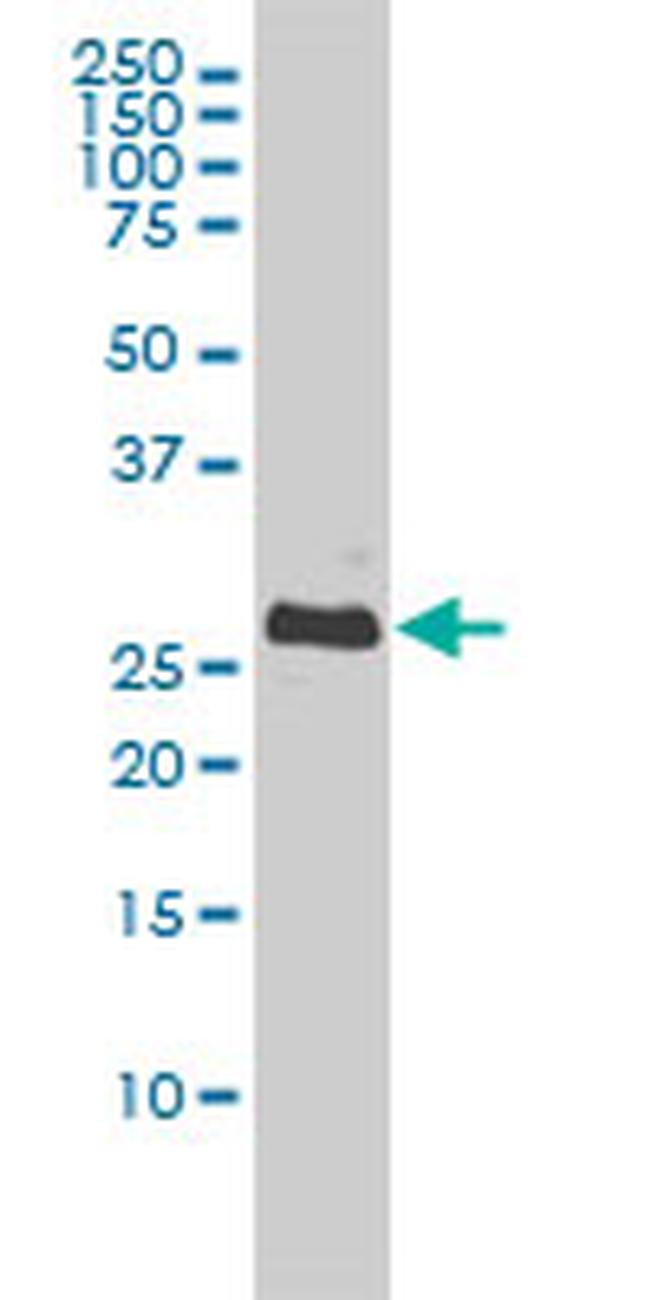 BCL2L1 Antibody in Western Blot (WB)