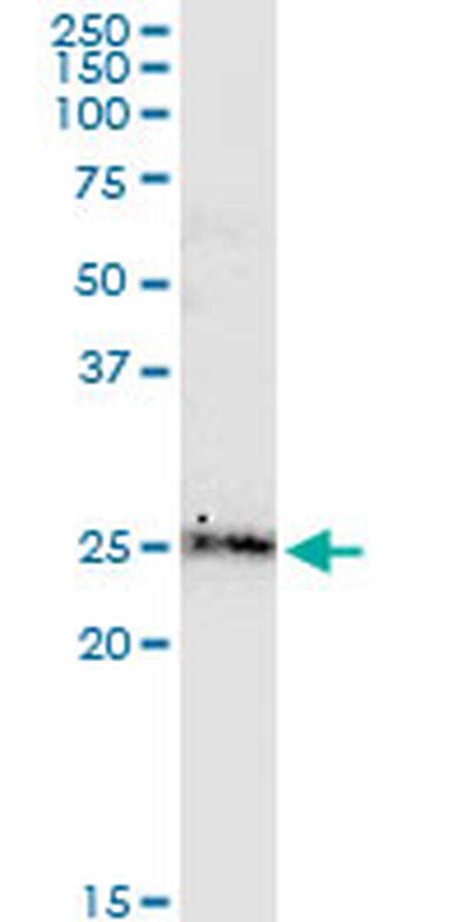 BCL2L2 Antibody in Western Blot (WB)