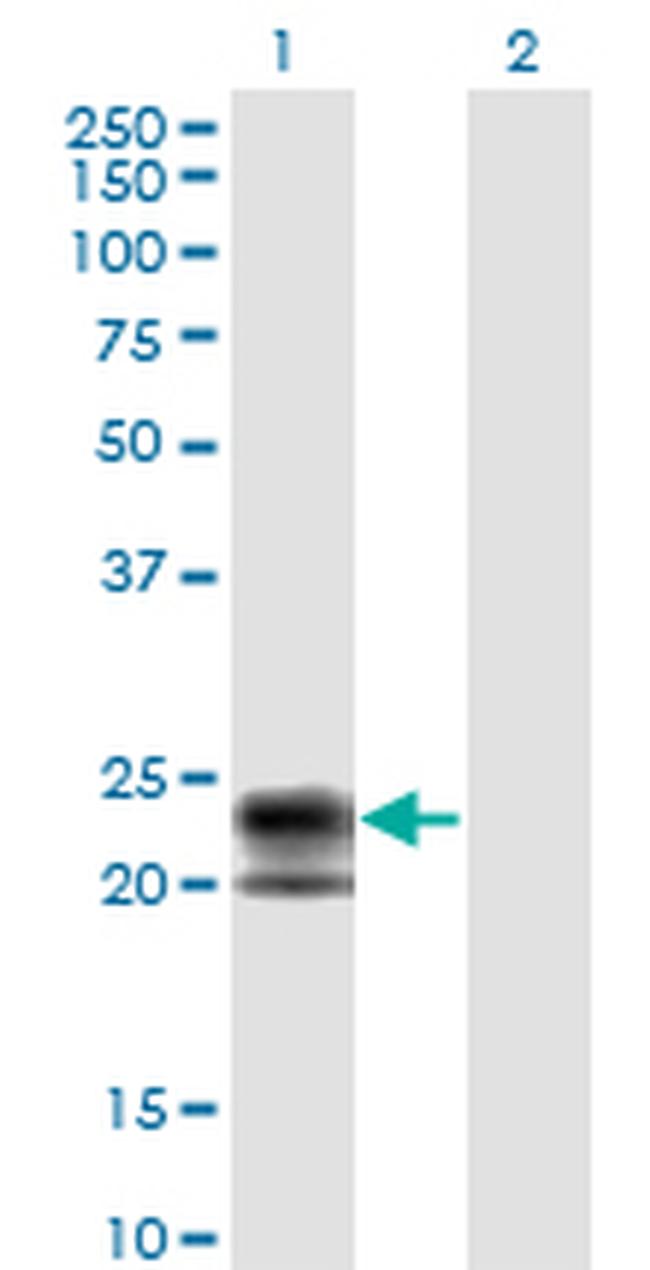 TNFRSF17 Antibody in Western Blot (WB)