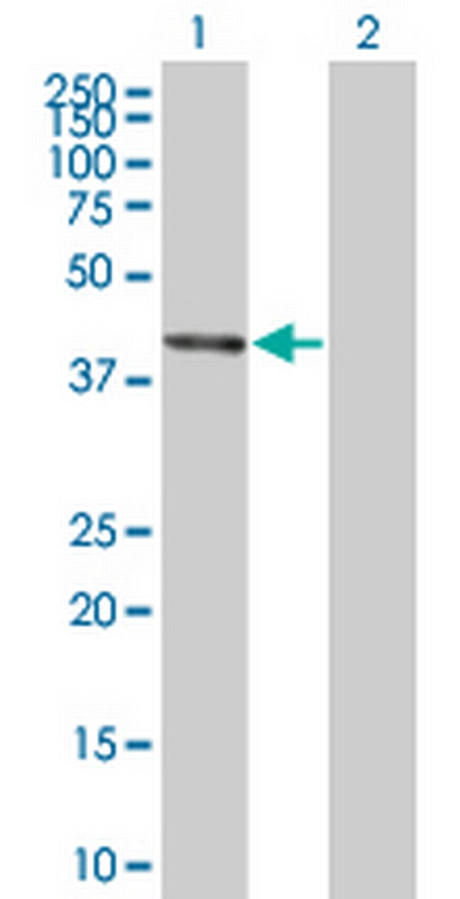 BCS1L Antibody in Western Blot (WB)