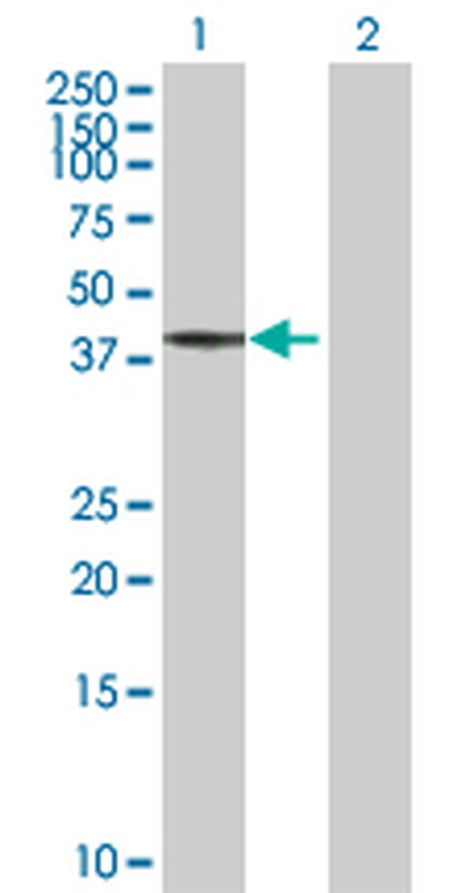 BCS1L Antibody in Western Blot (WB)