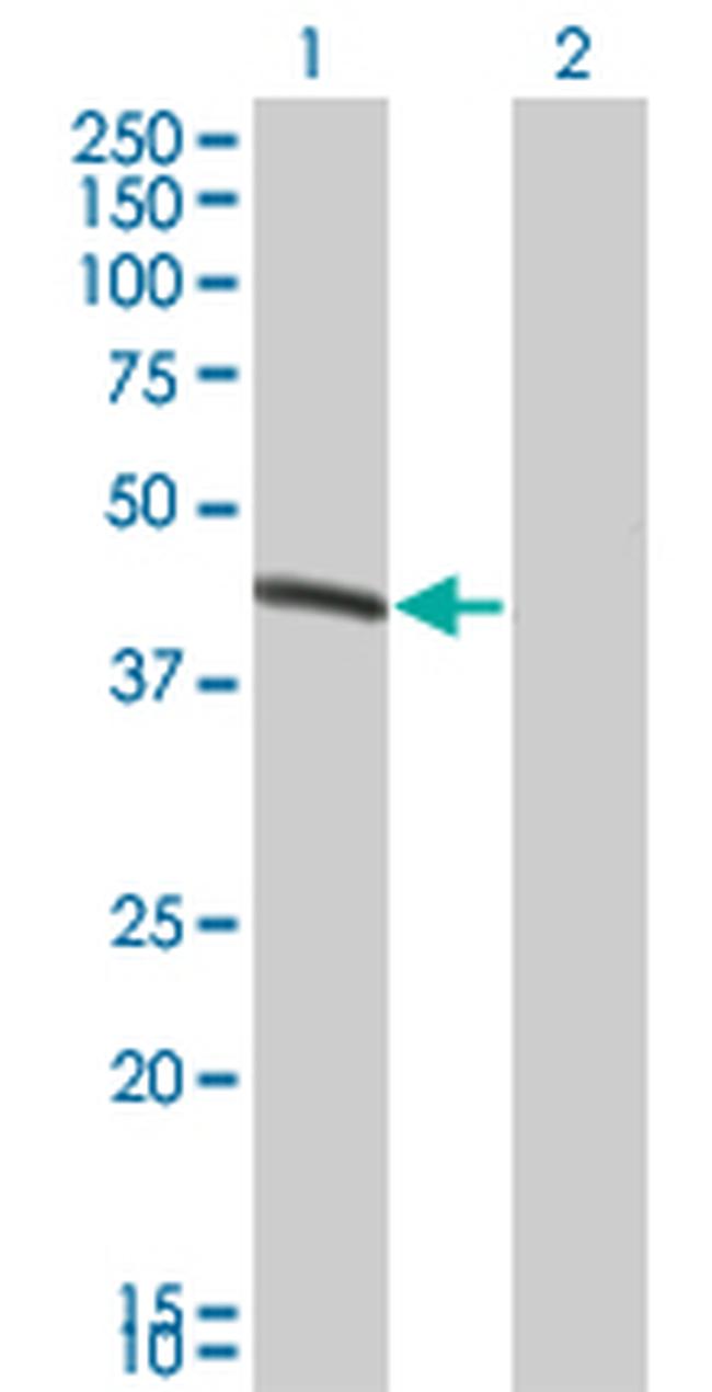 BCS1L Antibody in Western Blot (WB)