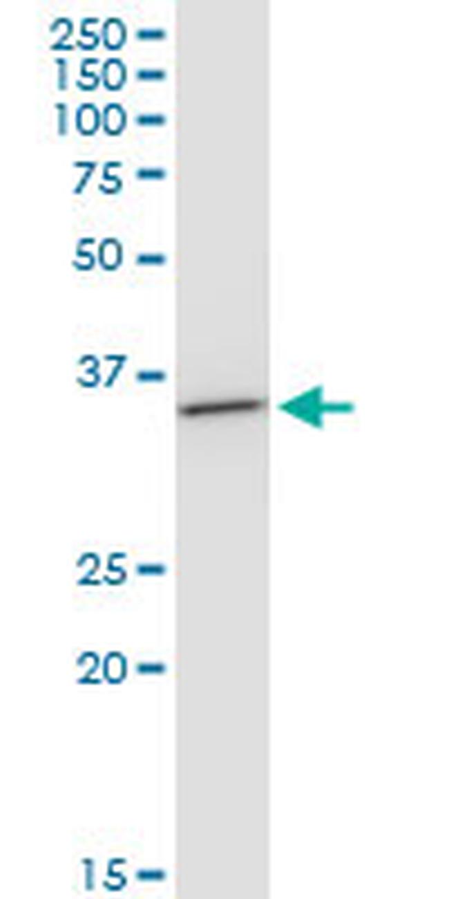 BDH1 Antibody in Western Blot (WB)