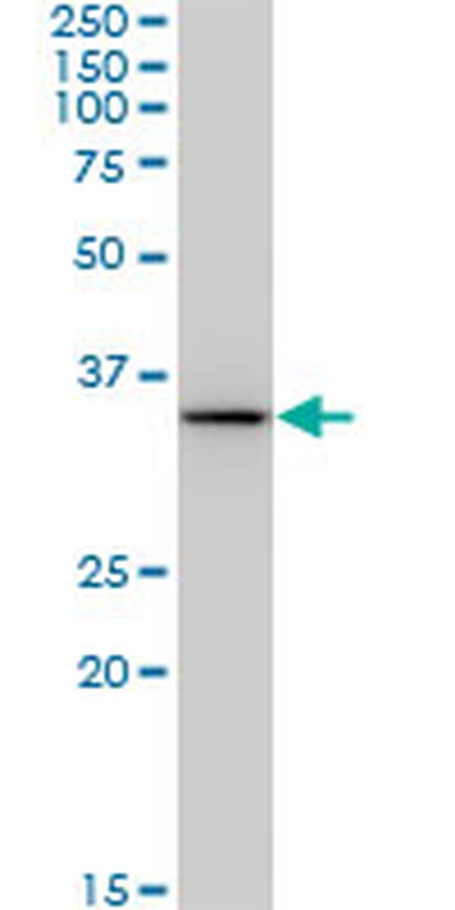 BDH1 Antibody in Western Blot (WB)