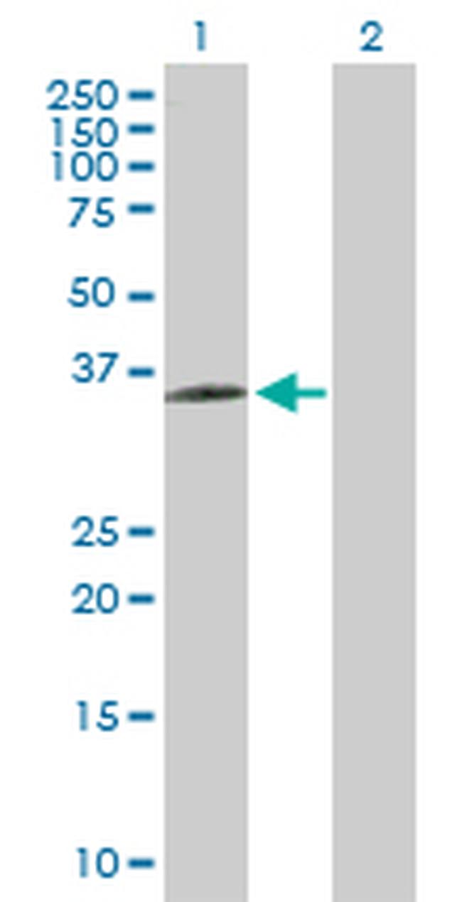 BDKRB1 Antibody in Western Blot (WB)