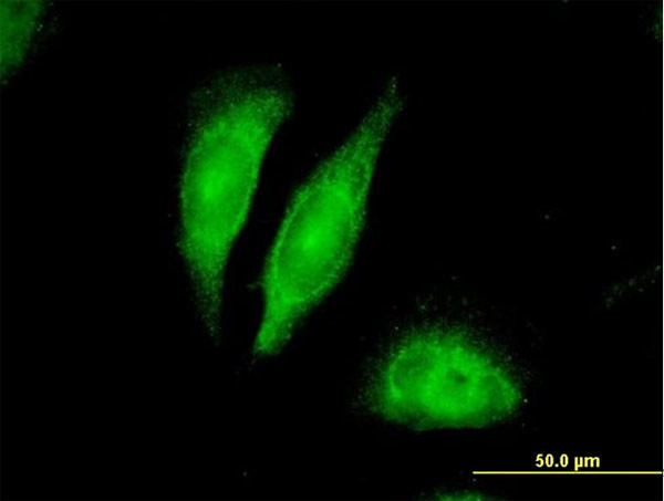 BDNF Antibody in Immunocytochemistry (ICC/IF)