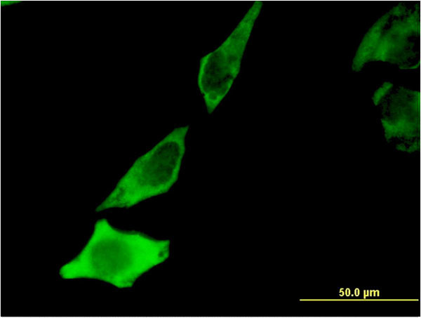 BDNF Antibody in Immunocytochemistry (ICC/IF)