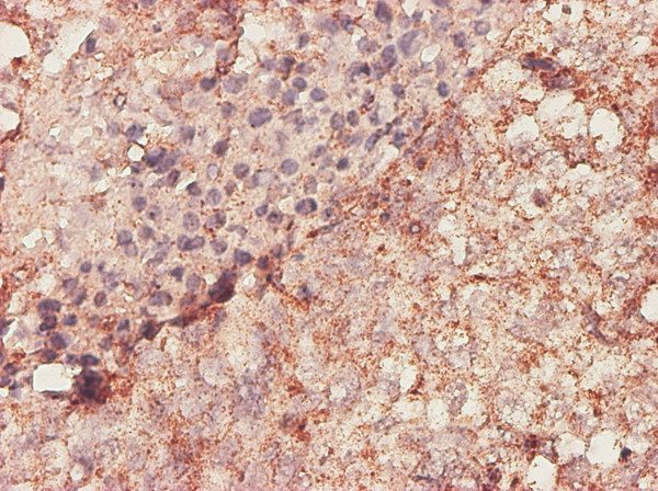 BGN Antibody in Immunohistochemistry (Paraffin) (IHC (P))