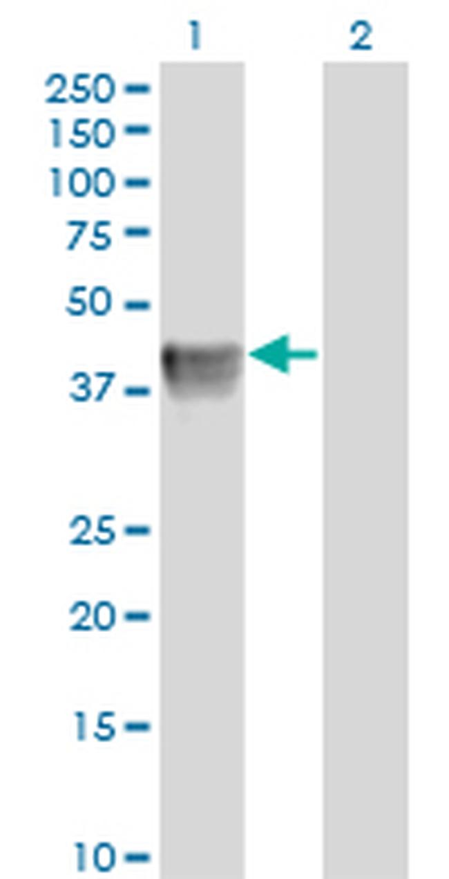 BGN Antibody in Western Blot (WB)