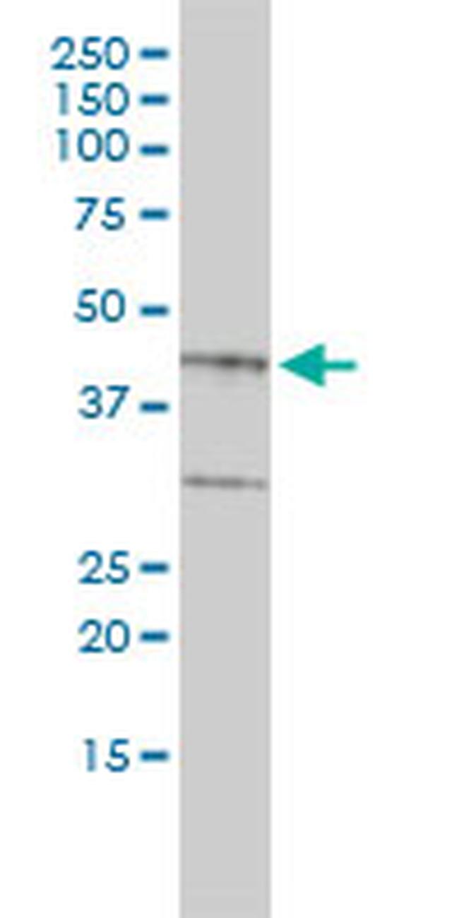 BGN Antibody in Western Blot (WB)