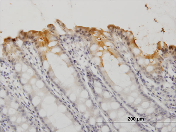 CEACAM1 Antibody in Immunohistochemistry (Paraffin) (IHC (P))