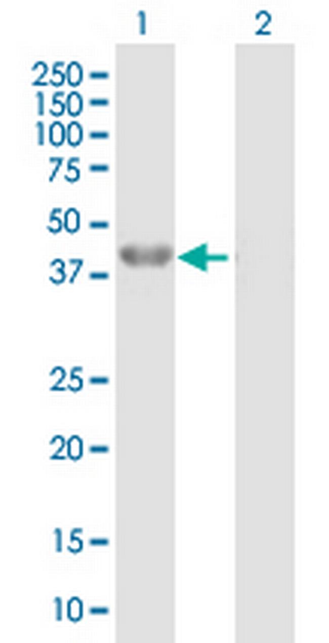 BHMT Antibody in Western Blot (WB)