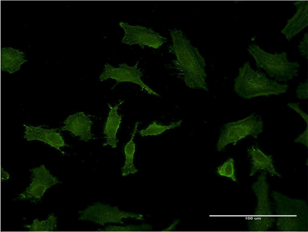 BID Antibody in Immunocytochemistry (ICC/IF)